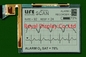 320*240 FSTN LCD Modülü Tek renkli Tıbbi Tarama için Pozitif